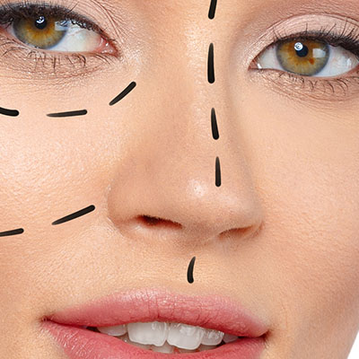 korekcja nosa - rhinoplastyka